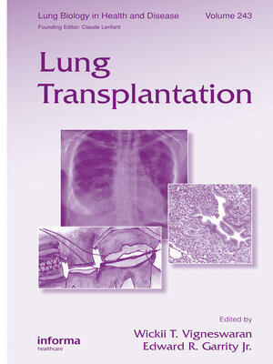cover image of Lung Transplantation